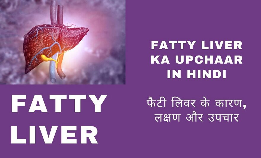 Fatty Liver ka Upchaar in Hindi