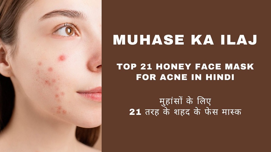 Muhase ka Ilaj – Top 21 Honey Face Mask for Acne in Hindi